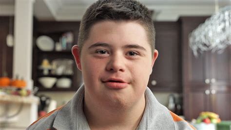 Why are the vast majority of people with Down syndrome。